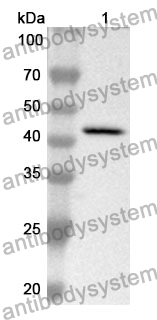 Anti-CD49e/ITGA5 Polyclonal Antibody