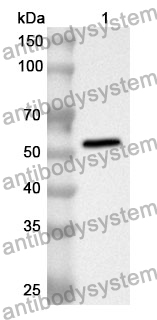 Anti-VIM/Vimentin Polyclonal Antibody