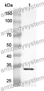 Anti-CYP21A2 Polyclonal Antibody