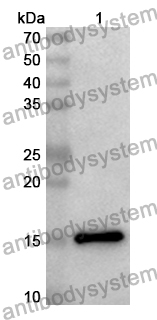 Anti-Human F7 Polyclonal Antibody