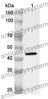 Anti-KRT19 Polyclonal Antibody