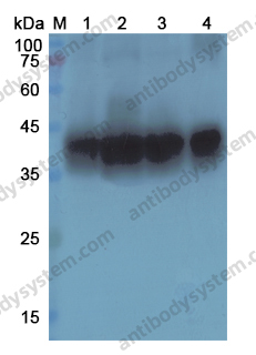 Anti-KRT19 Polyclonal Antibody