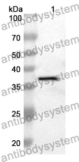 Anti-KRT7 Polyclonal Antibody