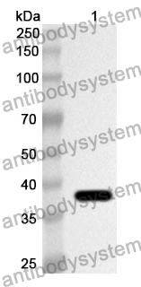 Anti-KRT16 Polyclonal Antibody