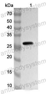 Anti-Human IGFBP1 Polyclonal Antibody