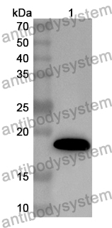 Anti-Human STS Polyclonal Antibody