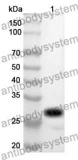 Anti-Elastase-3B/CELA3B Polyclonal Antibody