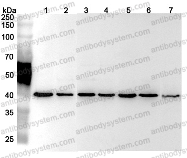 Anti-Human RPSA Polyclonal Antibody