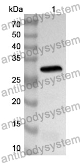 Anti-CD126/IL6R/IL-6RA Polyclonal Antibody