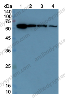 Anti-CD126/IL6R/IL-6RA Polyclonal Antibody