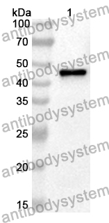 Anti-Human ABHD2 Polyclonal Antibody