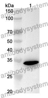 Anti-Human ROS1 Polyclonal Antibody