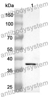 Anti-NMB Polyclonal Antibody