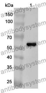 Anti-CELA3A Polyclonal Antibody