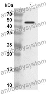 Anti-ENO2/NSE Polyclonal Antibody