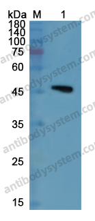 Anti-ENO2/NSE Polyclonal Antibody