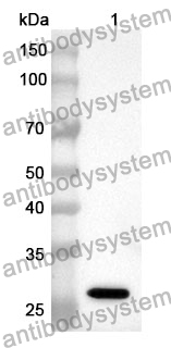 Anti-ACAA1 Polyclonal Antibody