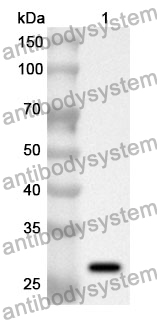 Anti-DBH Polyclonal Antibody