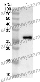 Anti-GSTA2 Polyclonal Antibody