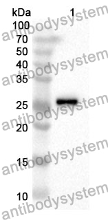 Anti-GSTP1 Polyclonal Antibody