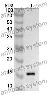 Anti-CST2 Polyclonal Antibody