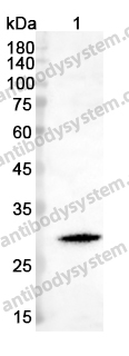 Anti-MMP7 Polyclonal Antibody