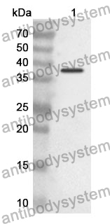 Anti-VIL1 Polyclonal Antibody