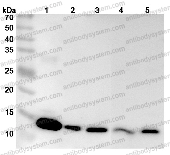 Anti-Human Gal-1/LGALS1 Polyclonal Antibody