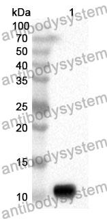 Anti-RBP1 Polyclonal Antibody