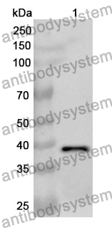 Anti-FBP1 Polyclonal Antibody