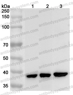 Anti-Human GNAO1 Polyclonal Antibody