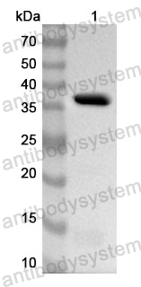 Anti-SPARC/Osteonectin Polyclonal Antibody