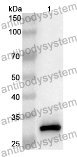 Anti-Human GSTM1 Polyclonal Antibody