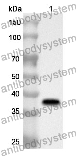 Anti-ANXA4 Polyclonal Antibody