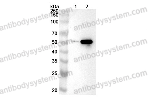 Anti-INHBB Polyclonal Antibody