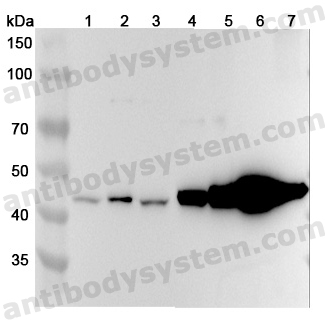 Anti-Human CNP Polyclonal Antibody