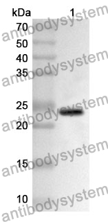 Anti-DLD Polyclonal Antibody