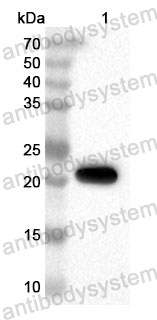 Anti-Human SNRPA1 Polyclonal Antibody