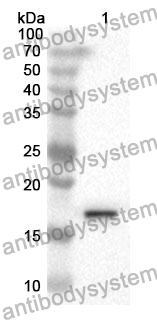 Anti-GIP Polyclonal Antibody