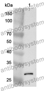 Anti-C1S Polyclonal Antibody