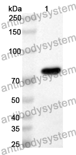 Anti-Human IFIT2 Polyclonal Antibody