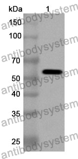 Anti-Human IFIT1 Polyclonal Antibody