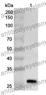 Anti-ALOX5 Polyclonal Antibody