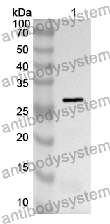 Anti-UCHL1 Polyclonal Antibody