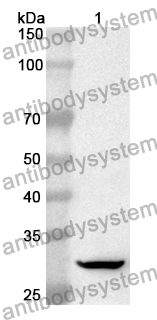 Anti-ALDOC Polyclonal Antibody