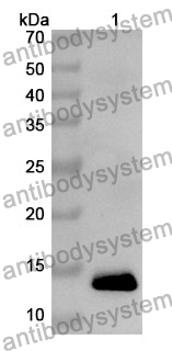 Anti-OCM Polyclonal Antibody