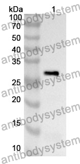 Anti-GSTT2 Polyclonal Antibody