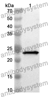 Anti-Human SAA1 Polyclonal Antibody