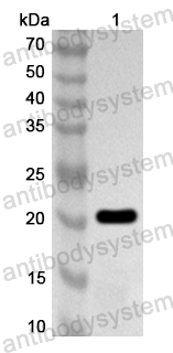 Anti-Human CSH1 Polyclonal Antibody