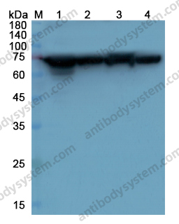 Anti-HSPA1A Polyclonal Antibody